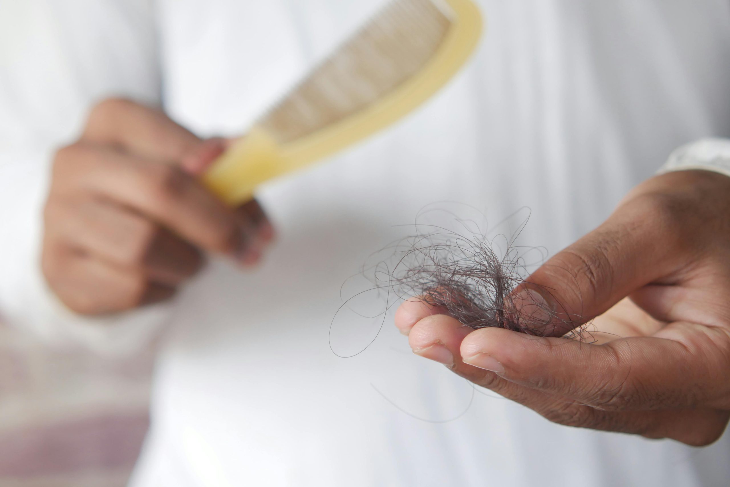 Man holding hair that fell out
